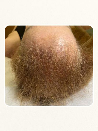 After skincare treatment at CaraBella Skin