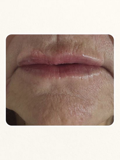 After skincare treatment at CaraBella Skin